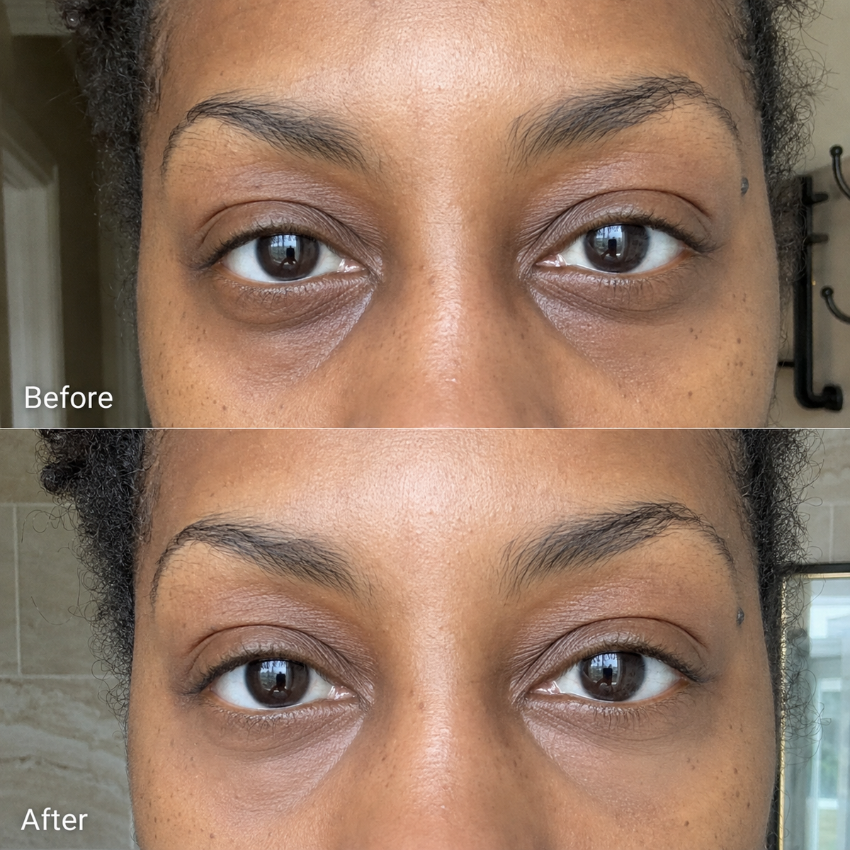 Rowoh EyeReset™ Collagen Eye Patches