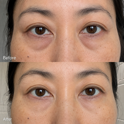 Rowoh EyeReset™ Collagen Eye Patches