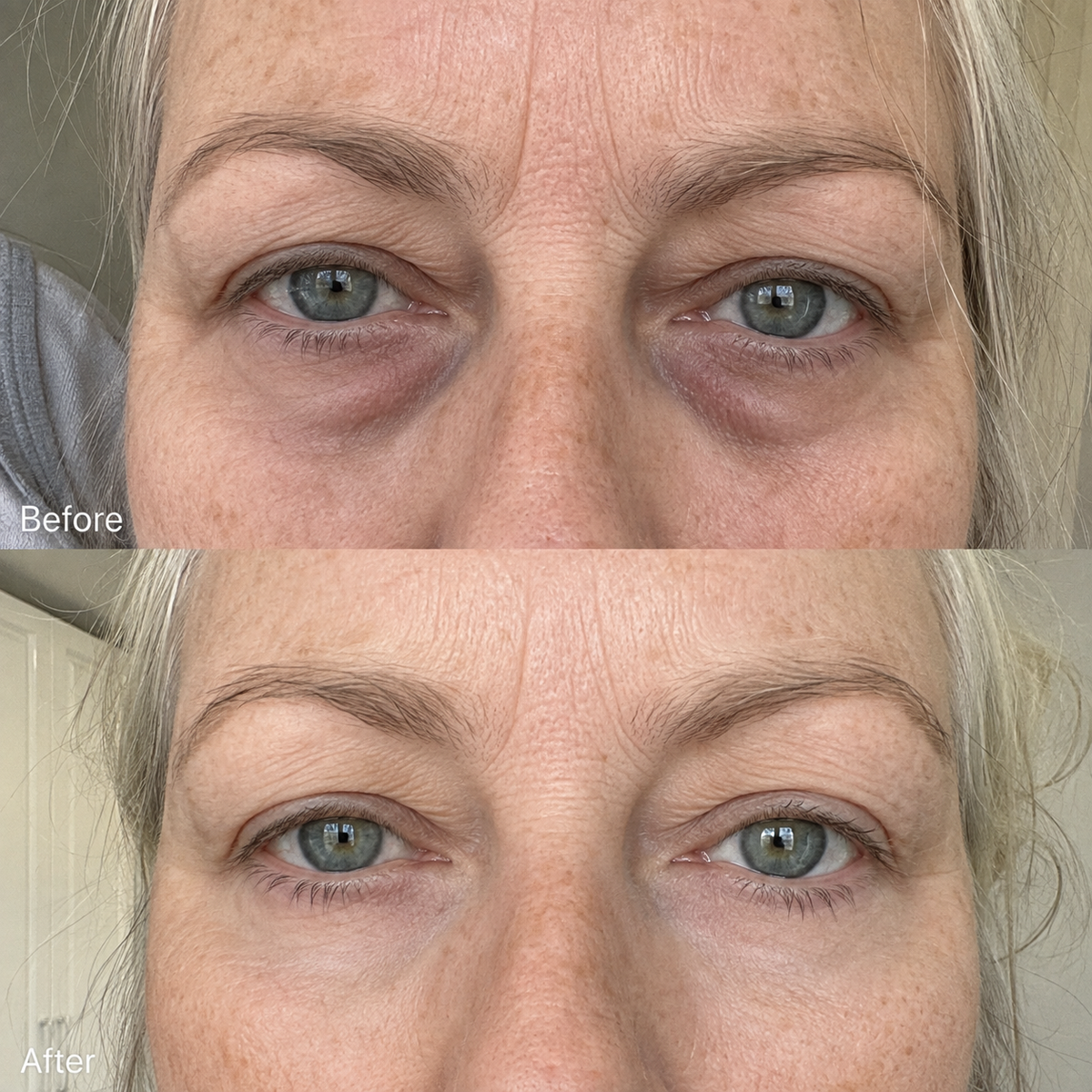 Rowoh EyeReset™ Collagen Eye Patches