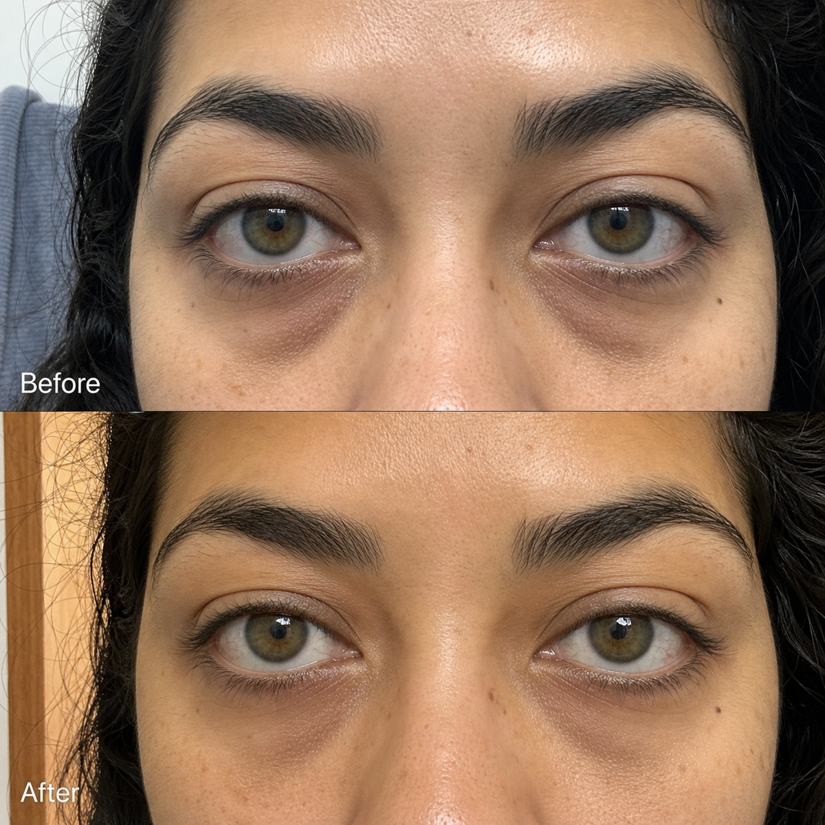 Rowoh EyeReset™ Collagen Eye Patches