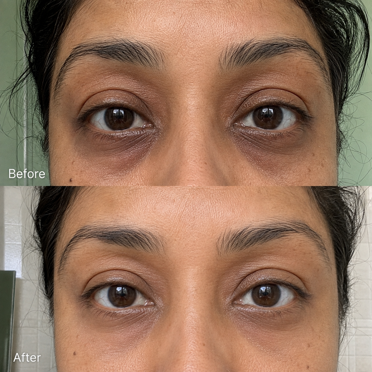 Rowoh EyeReset™ Collagen Eye Patches