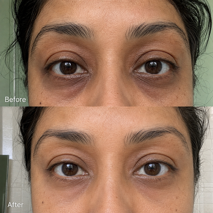 Rowoh EyeReset™ Collagen Eye Patches